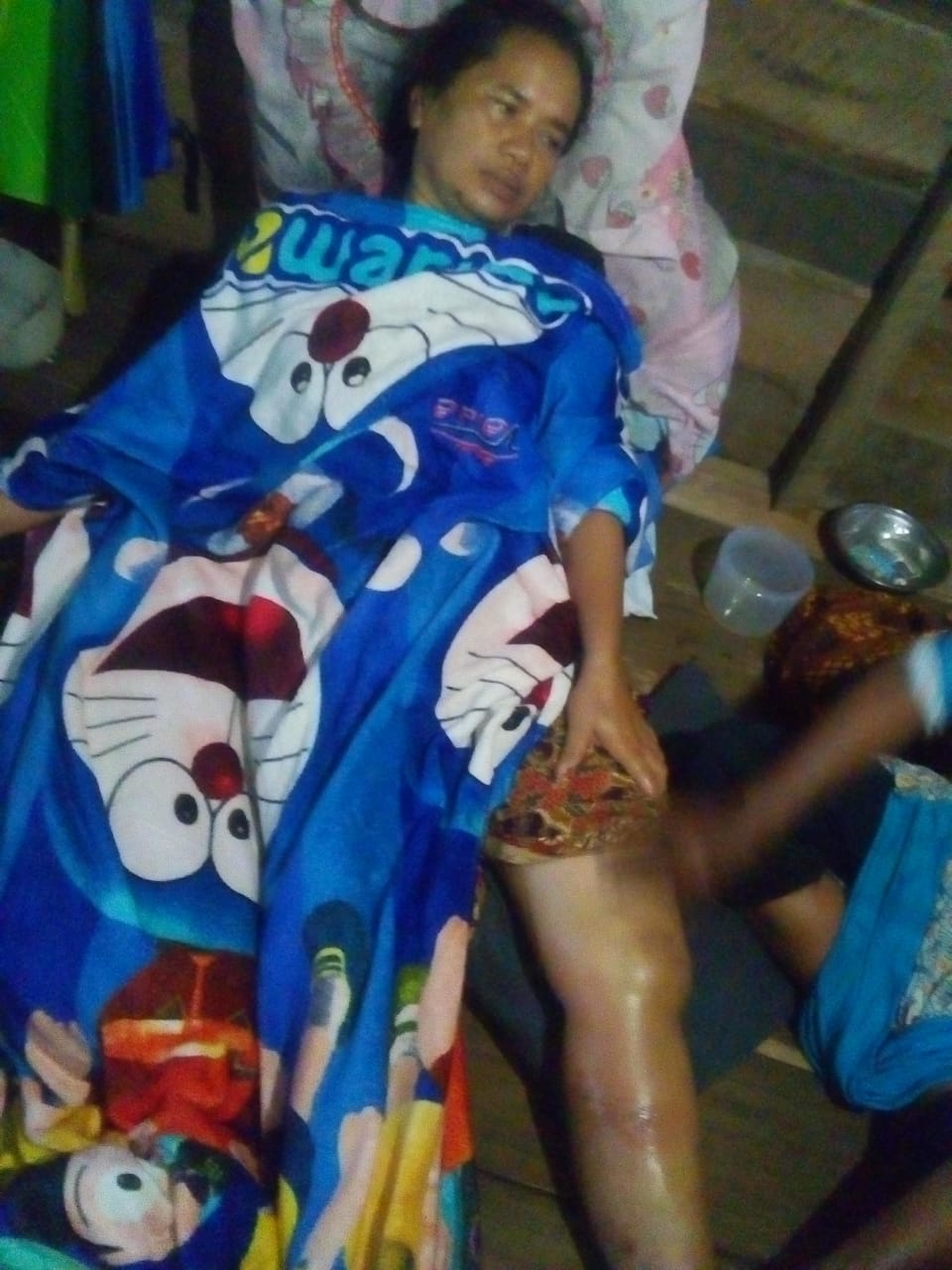 Ini Kronologi IRT di Sampit Diterkam Buaya, Berhasil Selamat Setelah Buaya Ditombak